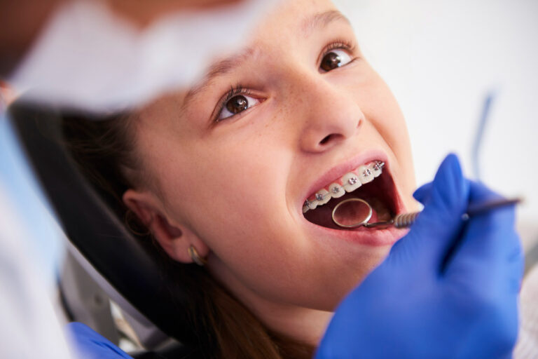 criança com aparelho ortodôntico durante um exame dentário de rotina